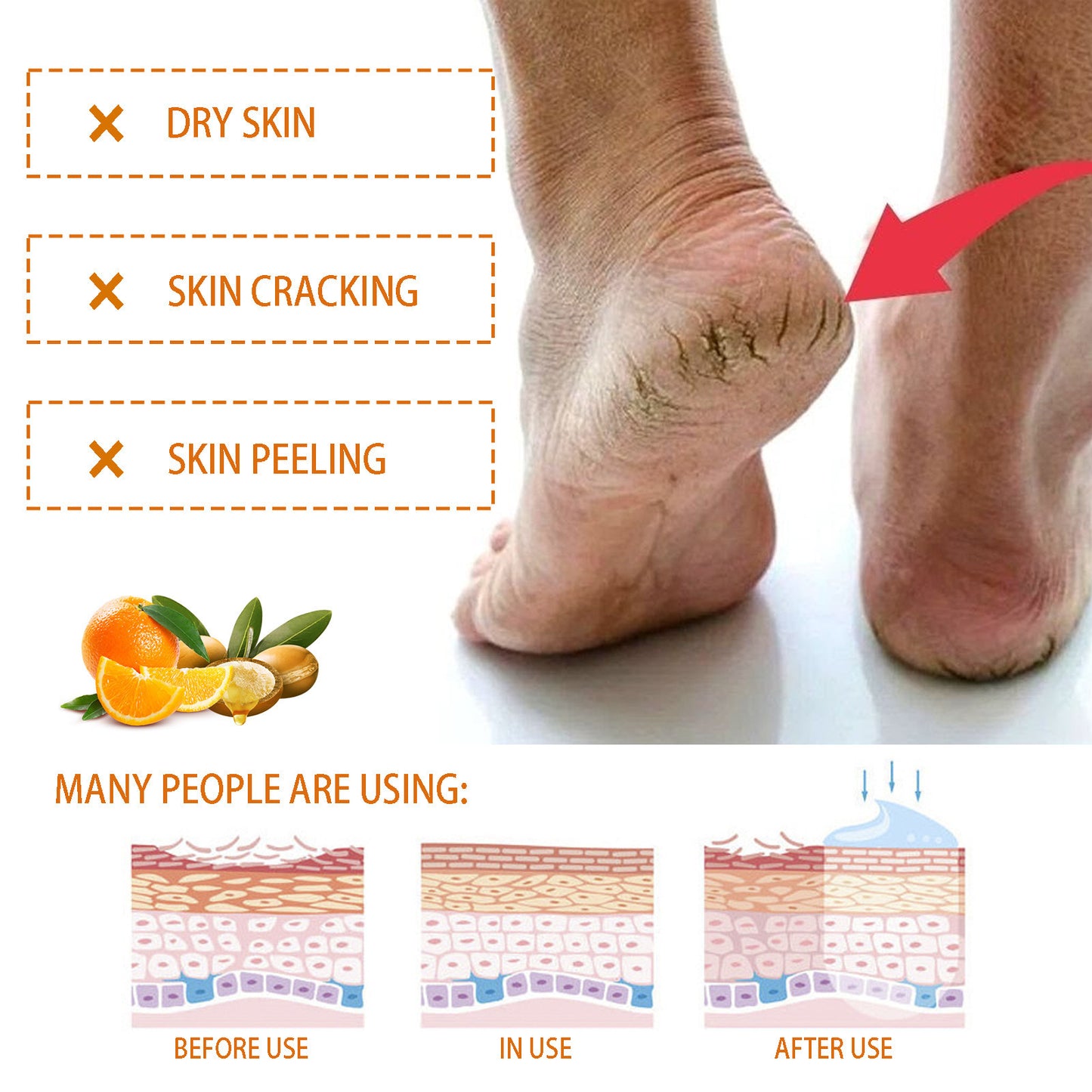 Nourishing Hands And Feet Neck Cream Anti-chapping Hydrating
