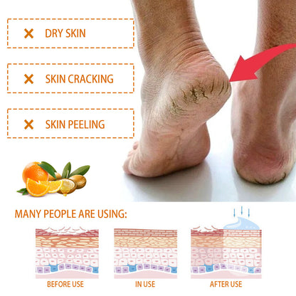 Nourishing Hands And Feet Neck Cream Anti-chapping Hydrating