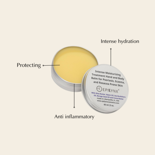 Crema Idratante Intensiva al Burro di Karité – Per Pelle Secca 🌿