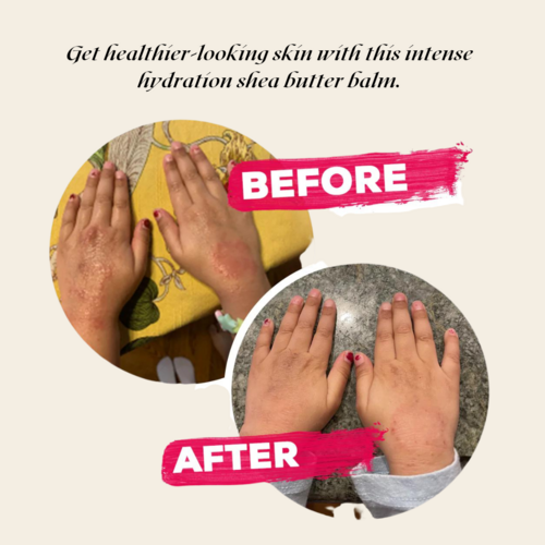 Crema Idratante Intensiva al Burro di Karité – Per Pelle Secca 🌿